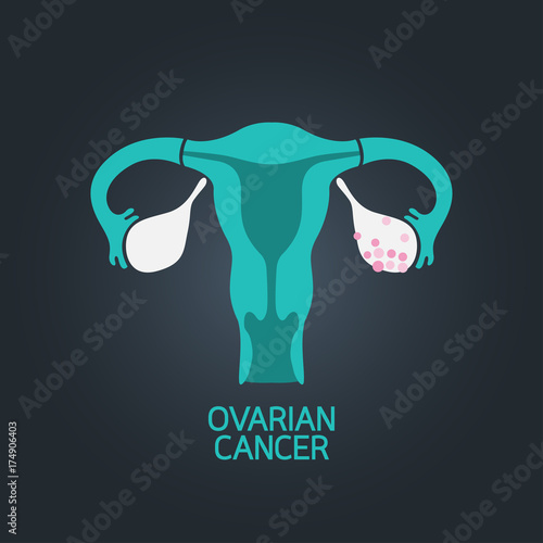Ovarian Cancer vector logo icon illustration