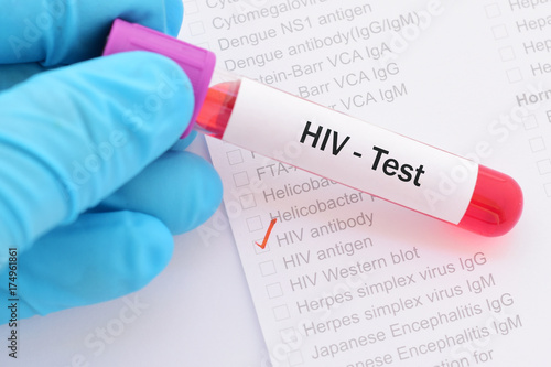 Blood sample for HIV test