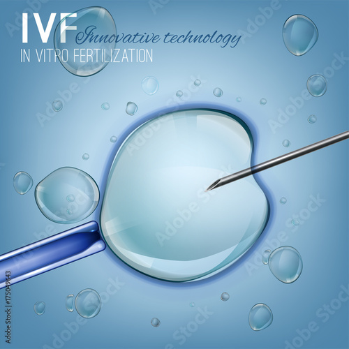 In Vitro Fertilization