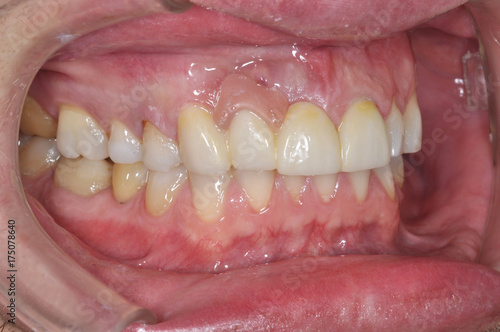 Close up of a patient's mouth at a dental clinic