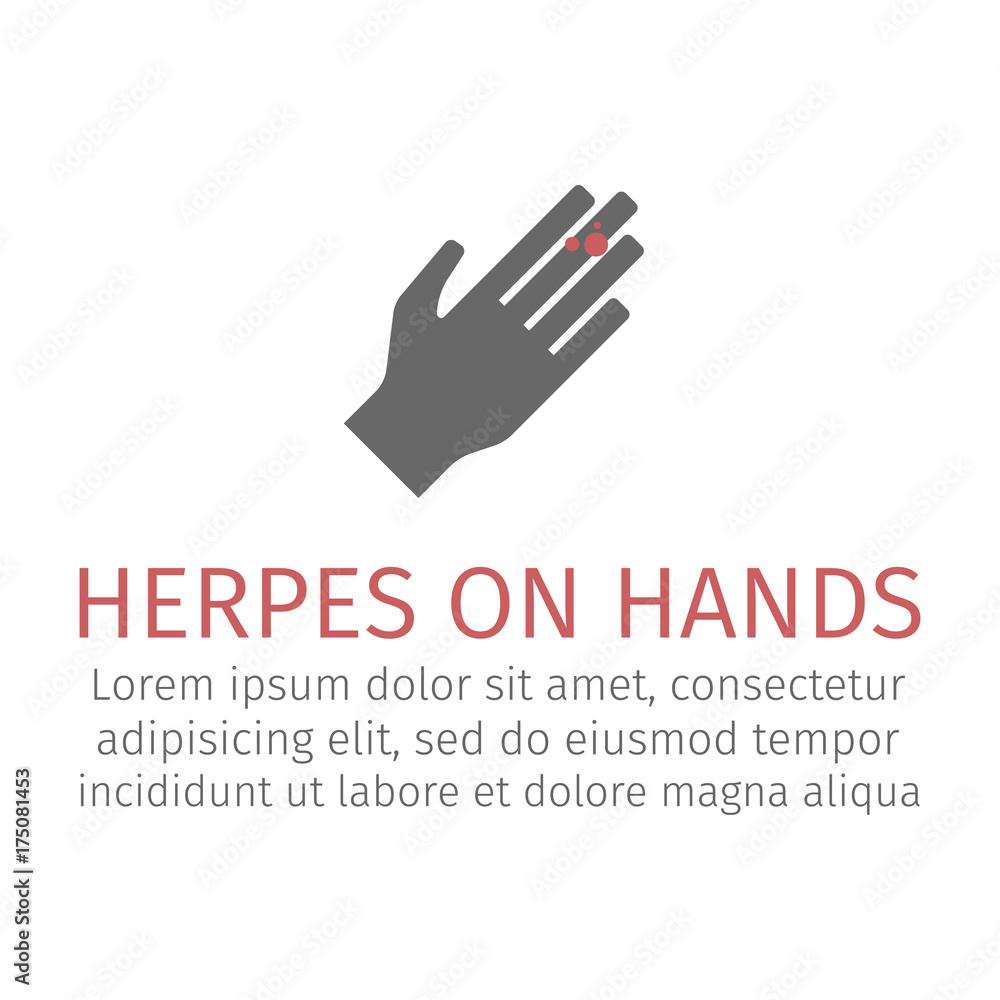 Fototapeta premium Herpes on hands. Vector icon