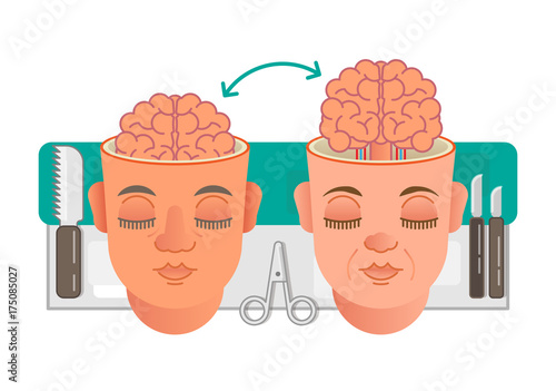 Brain transplantation concept illustration. 
Two illustrated heads showing brain transplantation conceptual illustration.