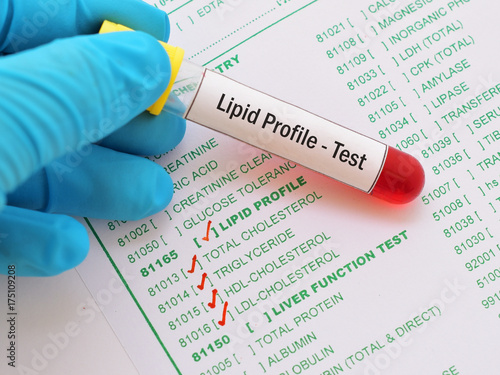 Blood sample with requisition form for lipid profile test photo