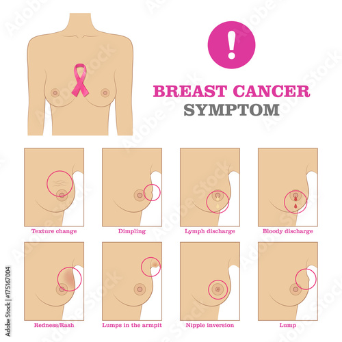 Breast cancer symptom. Warning signs and danger, unusual changes and pain. Information poster. Female healthcare concept. White background vector illustration