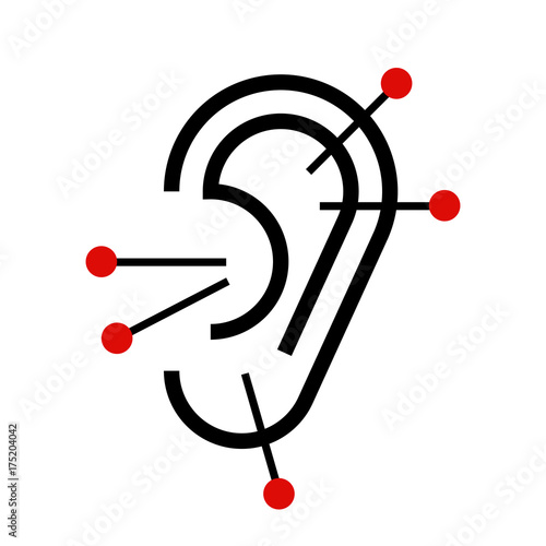 Ear acupuncture