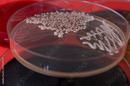 Macro of bacteria colony on petri dish. Candida albicans bacteria on agar plate