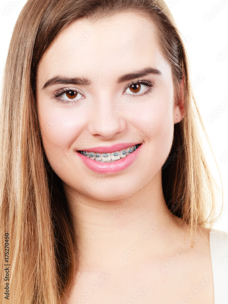 Woman showing her teeth with braces Woman showing her teeth with braces