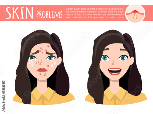 acne treatment before after, facial cleansing foam, cartoon illustration
