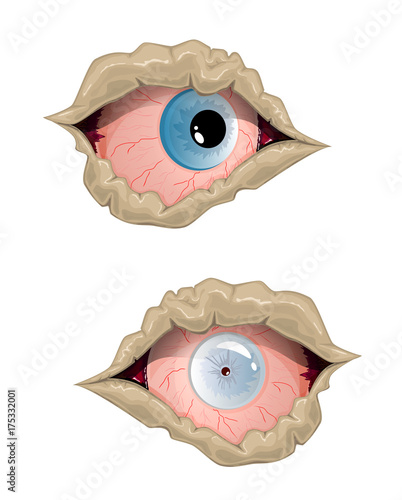 Eyes zombie
