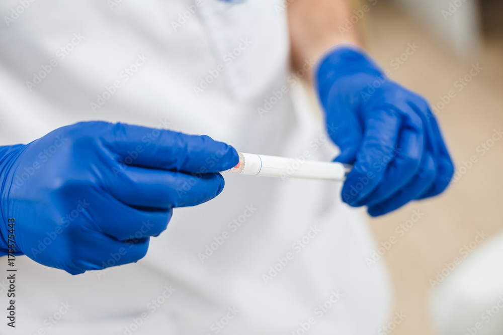 Close up view of DNA swab of saliva in doctor's hands. Men's hands in blue gloves hold DNA swab of saliva. Close up view of DNA swab of saliva in doctor's hands. Men's hands in blue gloves hold DNA swab of saliva.