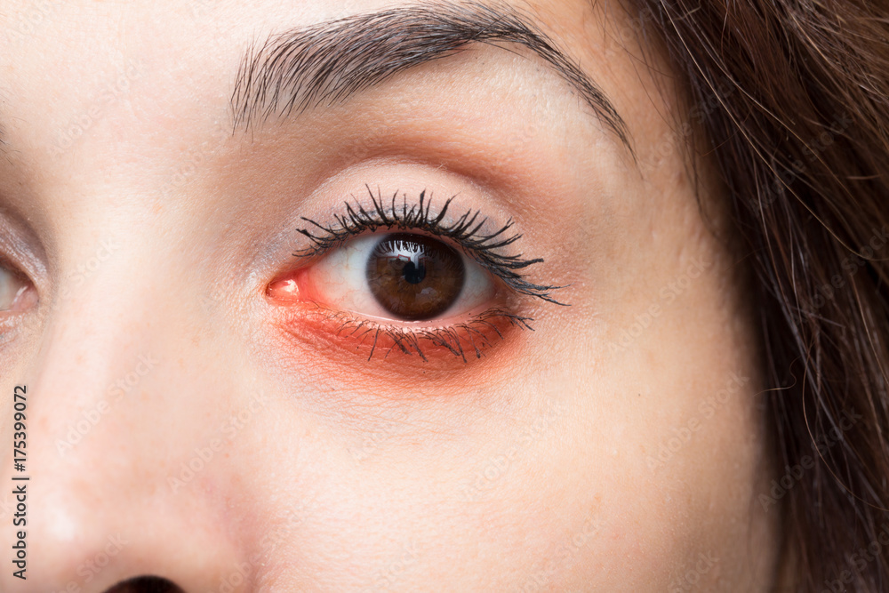 Obraz premium Woman red eye