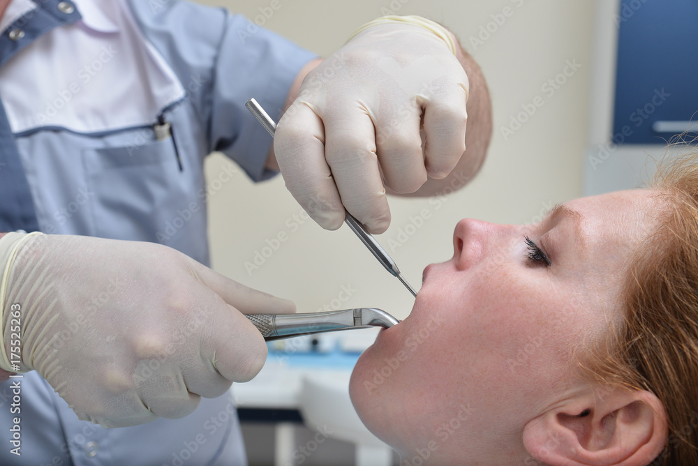 Tooth Extraction procedure with forceps, closeup portrait of woman patient during operation in dentist clinic Tooth Extraction procedure with forceps, closeup portrait of woman patient during operation in dentist clinic