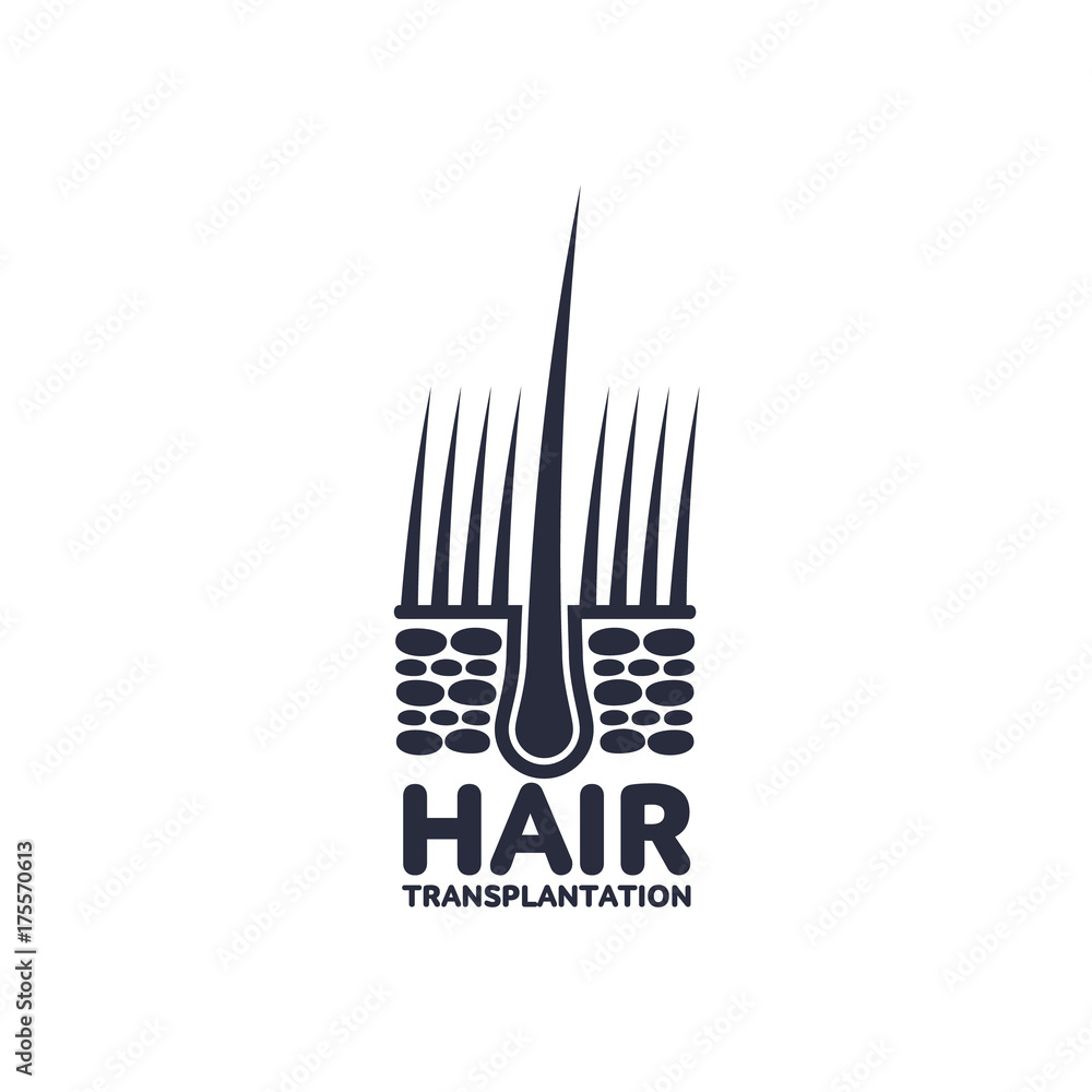 Hair follicle in hair bulb with human skin, dermis. Medical folicle transplantation company logo, brand icon pictogram design. Vector flat silhouette illustration isolated on a white background. Hair follicle in hair bulb with human skin, dermis. Medical folicle transplantation company logo, brand icon pictogram design. Vector flat silhouette illustration isolated on a white background.