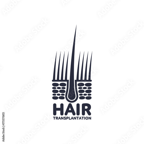 Hair follicle in hair bulb with human skin, dermis. Medical folicle transplantation company logo, brand icon pictogram design. Vector flat silhouette illustration isolated on a white background.