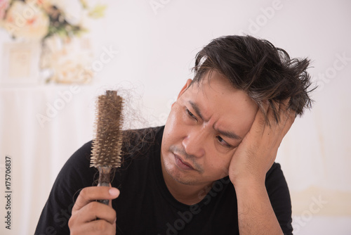 Portrait of asian man  problem hair on white background. This image for hair loss concept.  Man shows her gray hair roots