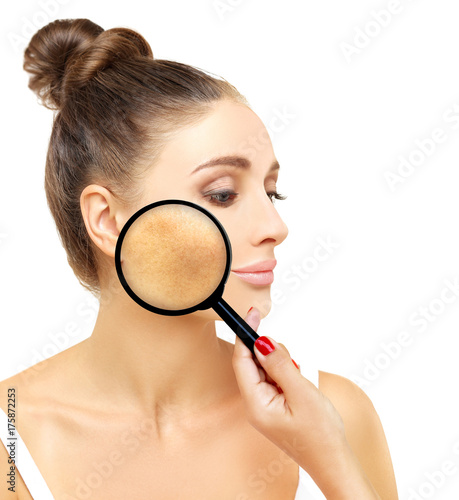 Dark spots, freckles,hyperpigmentation(melasma or chloasma)
