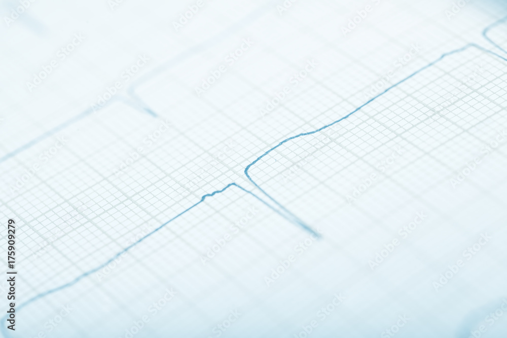 Curve line on the graph paper Curve line on the graph paper