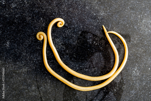 Ascariasis is a disease caused by the parasitic roundworm Ascaris lumbricoides for education in laboratories.