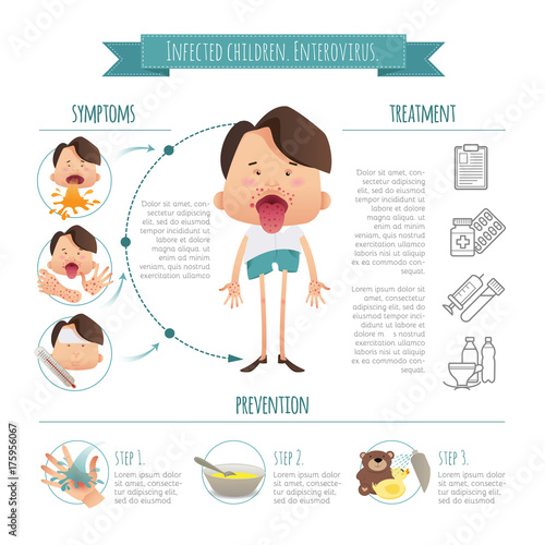 Infected children. Enterovirus. Hand-foot-mouth disease Infographics. Symptoms, prevention and treatment. Poster detail health concept