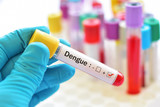 Dengue virus positive