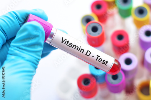 Blood sample for vitamin D test photo