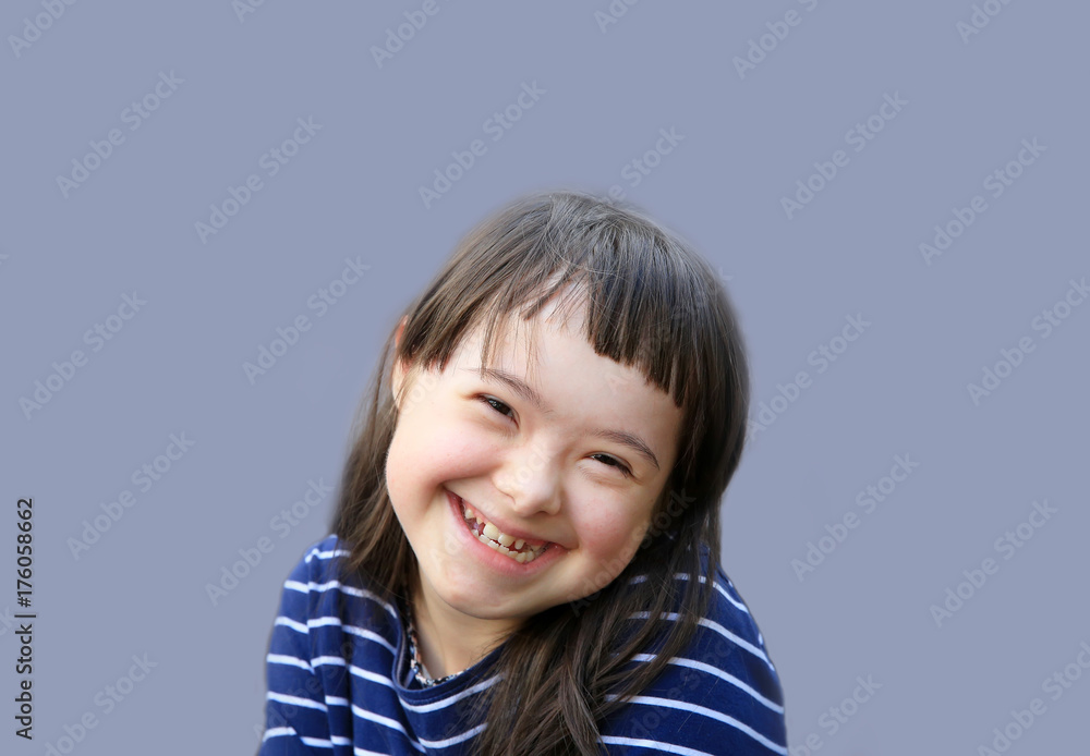 Cute smiling down syndrome girl on the blue background Cute smiling down syndrome girl on the blue background