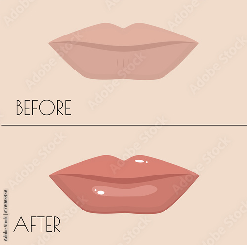 permanent makeup of lips. Before and after the procedure