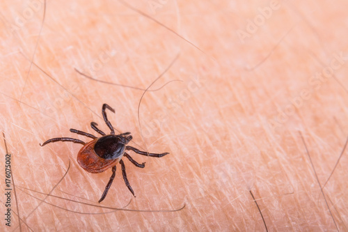Detail of deer tick on human skin. Ixodes ricinus. Dangerous parasite and carrier of infection such as encephalitis and Lyme borreliosis.  Tiresome insect. © KPixMining