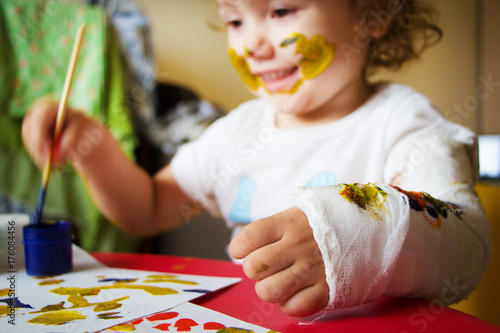 the child paints paints on a plaster of a hand. a broken arm in a small child