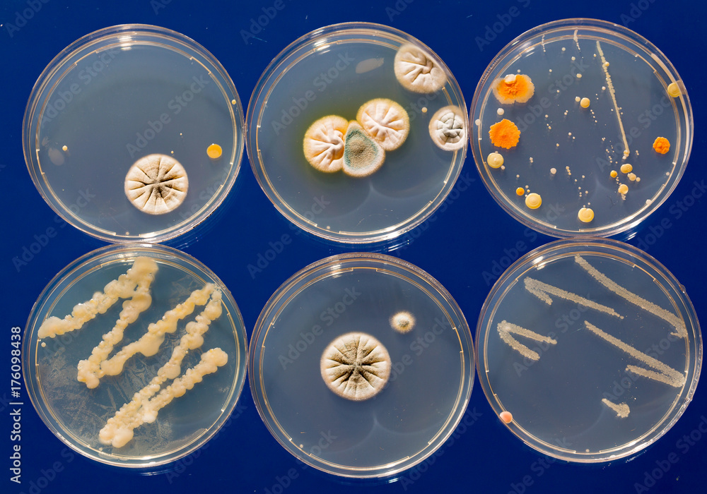 Petri dish with colonies of bacteria and fungi Stock Photo Adobe Stock