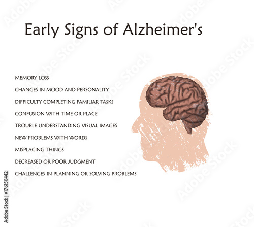 Alzheimer's disease early signs symptoms poster, banner. Vector medical illustration. White background, silhouette of old man head, list of signs, anatomy image of damaged human brain.