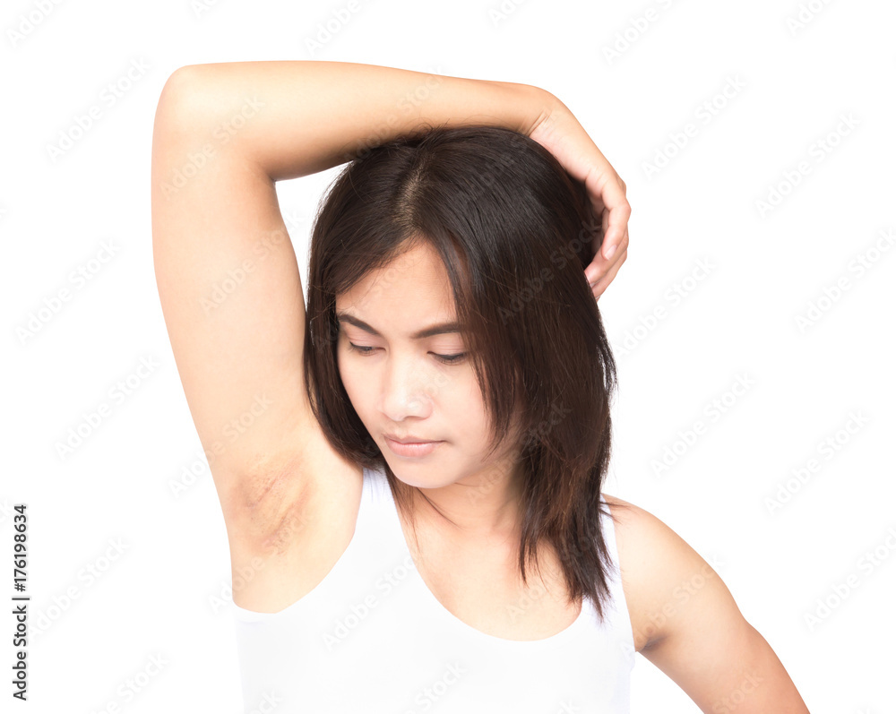 Women problem black armpit on white background for skin care and beauty concept Women problem black armpit on white background for skin care and beauty concept