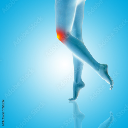 Conceptual beautiful woman or girl legs and feet with a hurt knee pain or ache closeup, 3D illustration of human slim fit body medical or health care concept, painful sport injury on blue background