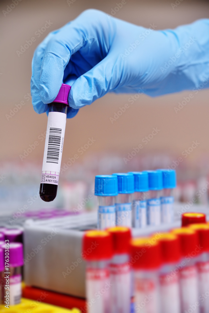 medical test tubes with blood tests on a laboratory background medical test tubes with blood tests on a laboratory background