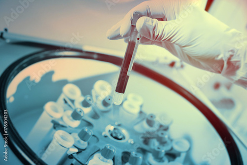 a glass test tube or a flask with blood in the hands of a scientist on the background of a laboratory photo