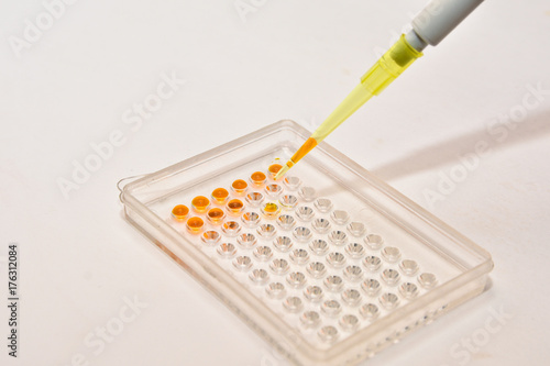 DNA testing in the laboratory.