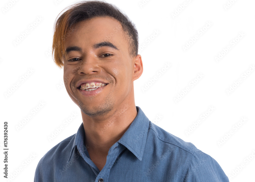 Smiling man using dental appliance. Black young man wears blue social shirt.. Smiling man using dental appliance. Black young man wears blue social shirt..