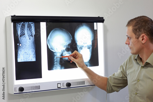 Specialist watching images of skull and spine at x-ray film viewer,. Diagnosis,treatment planning