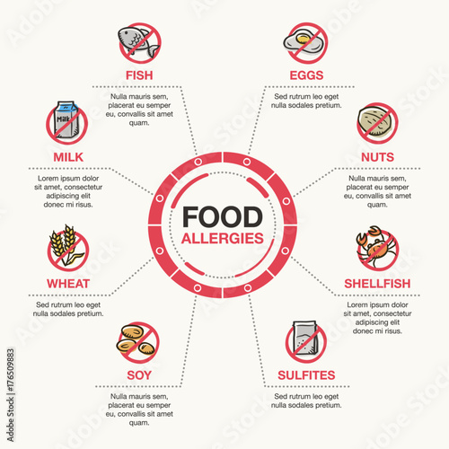 Vector infographic template for food allergies. Isolated on light background.