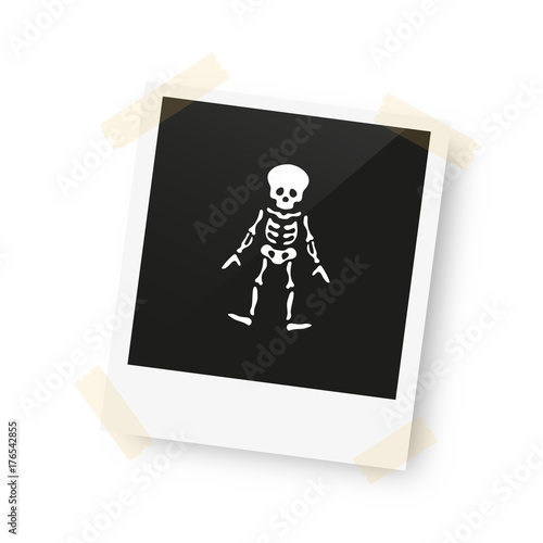 eingeklebtes Foto - Skelett