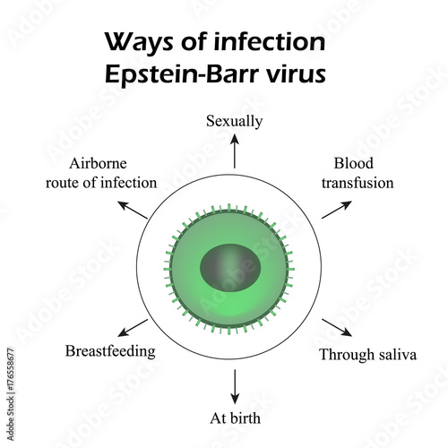 Epstein-Barr virus. Methods of infection. Infographics. Vector illustration