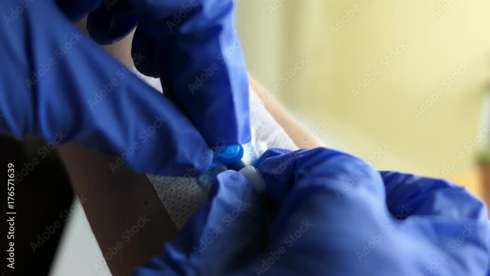 Nurse Inserting Intravenous Catheter Into Patient's Arm Nurse Inserting Intravenous Catheter Into Patient's Arm