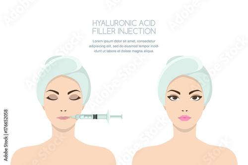 Beauty, cosmetology, anti-aging concept. Before and after vector illustration of beautiful woman having hyaluronic acid filler lips injection. Female rejuvenating injection against the wrinkles.