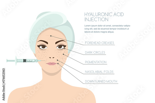 Hyaluronic acid facial injection, vector infographics design template. Beauty, cosmetology, anti-aging concept. Female rejuvenating mesotherapy injection against wrinkles and other signs of aging.