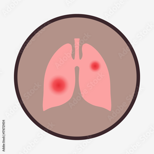 Pneumonia vector illustration