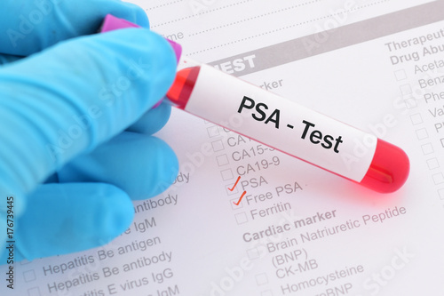 Blood for PSA test