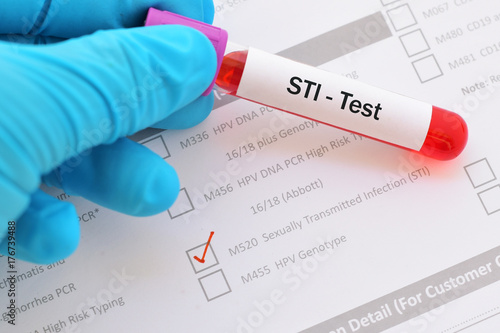 Blood sample with requisition form for sexually transmitted infection (STI) test