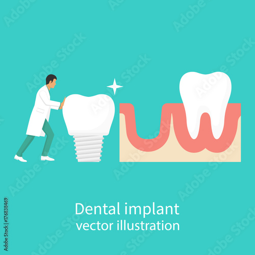 Dental implant. Dentist holding in hand of dentures. Medical equipment. Tooth treatment. Vector illustration flat design. Isolated on background. Stomatology concept.
