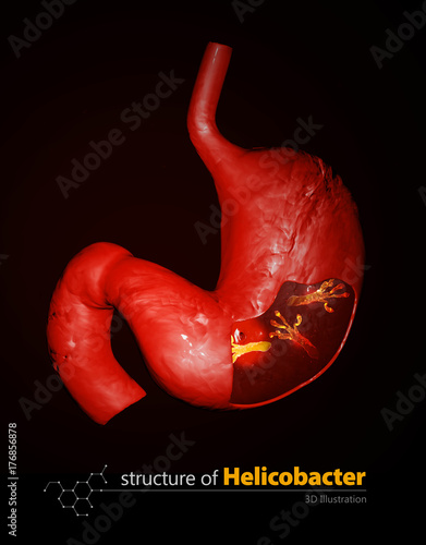 Принти на полотні Helicobacter Pylori, microaerophilic bacteria found in the stomach
