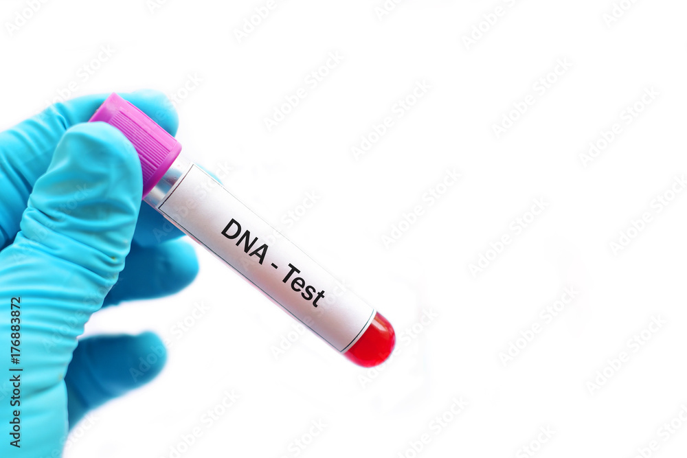 Fototapeta premium Test tube with blood sample for DNA test